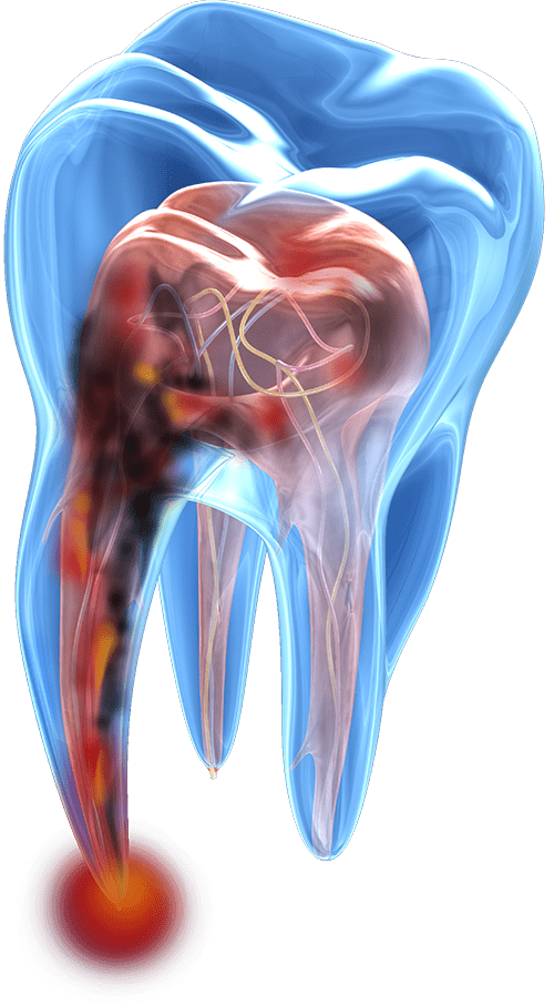 3d tooth graphic