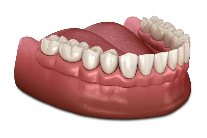 dentures model