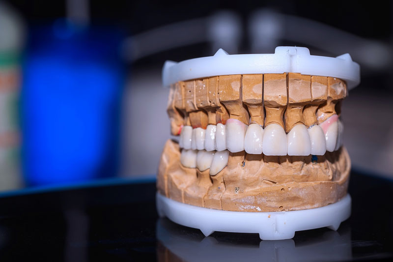Close up photo of a professional mouth prosthesis model.